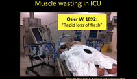 Promoting anabolism in the ICU...