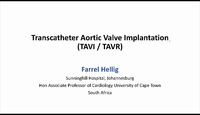 Transcatheter Aortic Valve Implantation...