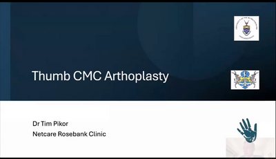 Arthroplasty of the Thumb CMC joint