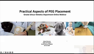 PEG insertion...