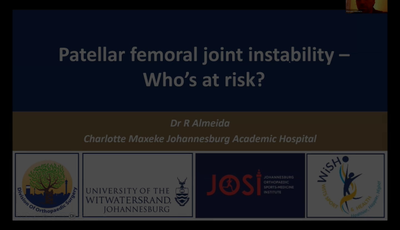 Risk of Patellar Femoral joint instability...