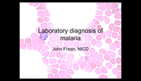 Laboratory Diagnosis of Malaria...