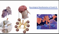 Neurological Manifestations of COVID-19...